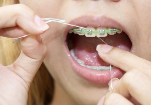 Ottawa-Dentist-Jaleel-Cleaning-Braces