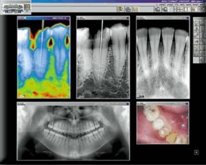 digital-X-rays-Preston-Dentists